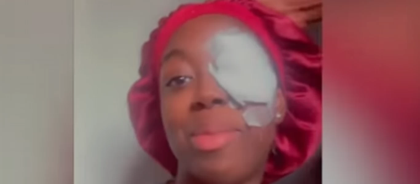 Έσκασε ο φορτιστής του κινητού της και παραλίγο να χάσει το μάτι της (βίντεο)